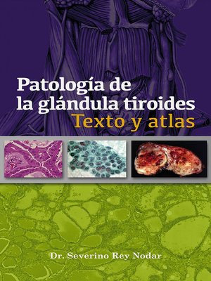 cover image of Patología de la glándula tiroides
